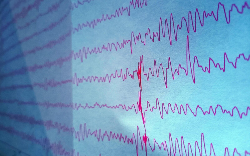 Electroencephalograms, a test that measures electrical activity in the brain, are shown. (Credit: Giulia Leo)